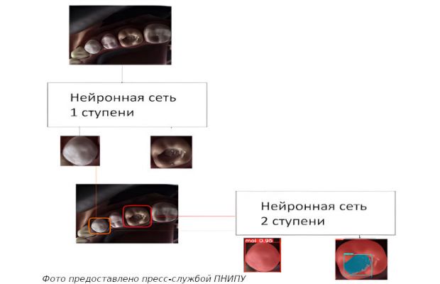 Ученые Пермского Политеха разработали систему для качественной оценки лечения зубов с использованием робота-тренажера